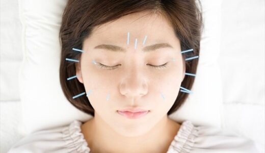 美容鍼で内出血になった体験記(写真付き) どのくらい目立つかや消えるまでの期間は？
